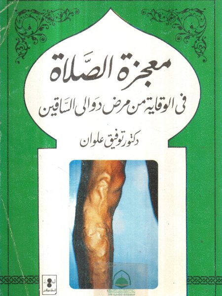 معجزة الصلاة في الوقاية من مرض دوالي الساقين