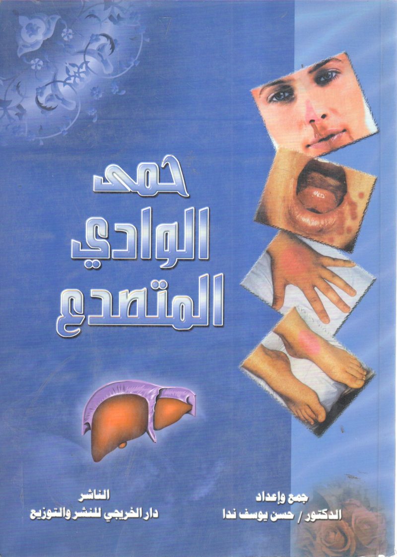 حمى الوادي المتصدع