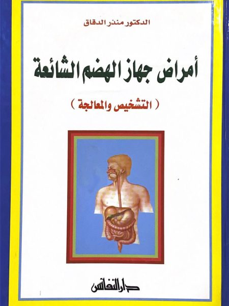 امراض جهاز الهضم الشائعة - التشخيص والعلاج